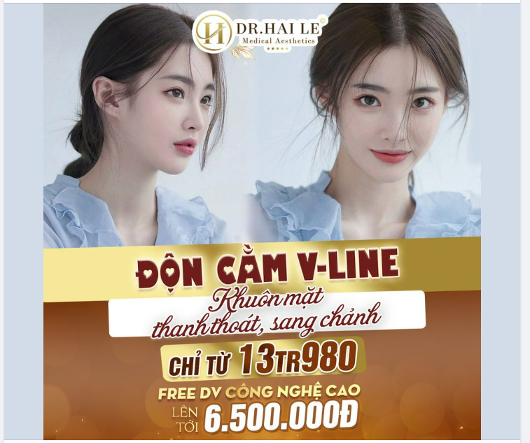 Muốn cằm thon gọn, mặt thanh thoát -ĐỪNG ngại ngần lựa chọn ngay Độn cằm V-line tại Dr.Hải Lê nàng nhé