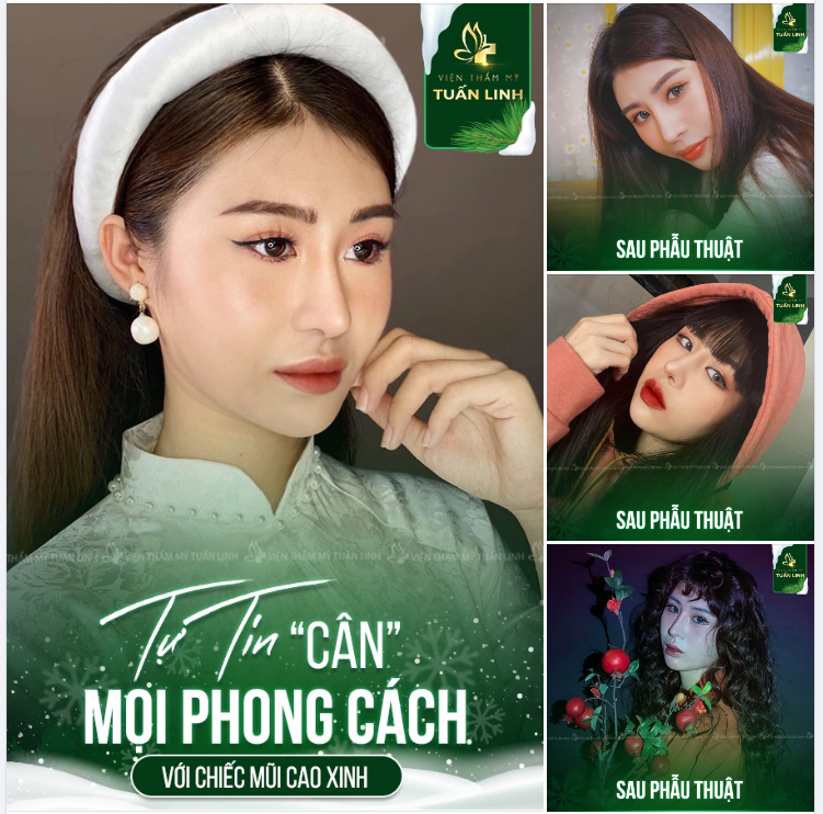 Là một makeup artist, bạn M.D muốn thay đổi dáng mũi để khuôn mặt cân đối hài hòa, tôn lên từng layout trang điểm của mình.
