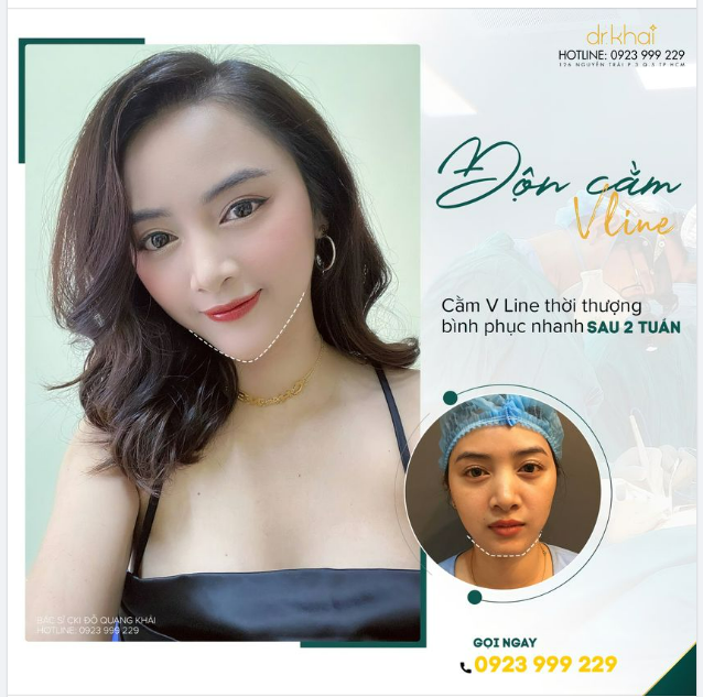 ĐỘN CẰM V LINE - ĐÓN TẾT TRIỆU LIKE