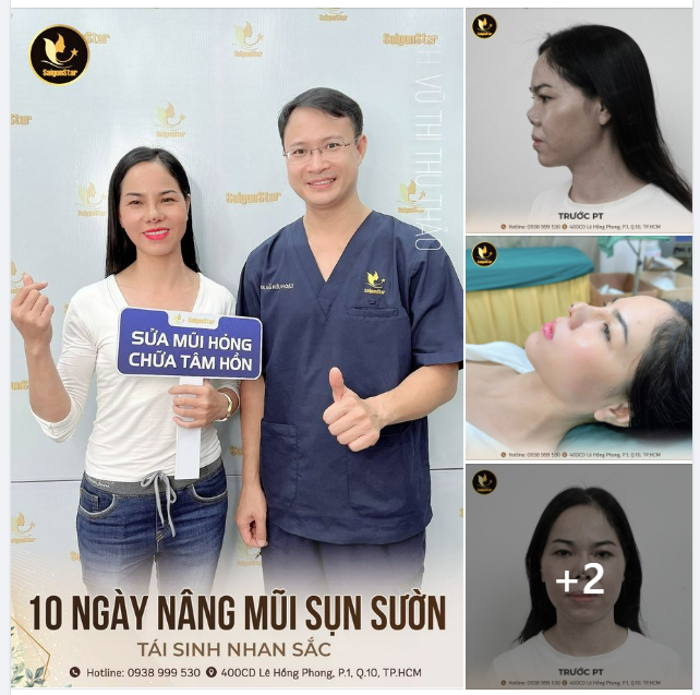 10 NGÀY NÂNG MŨI SỤN SƯỜN TÁI SINH NHAN SẮC NỤ CƯỜI TRỞ LẠI VỚI NGƯỜI MẸ ĐƠN THÂN