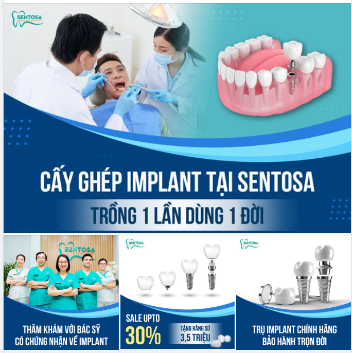 ƯU ĐÃI TRỒNG RĂNG CUỐI NĂM