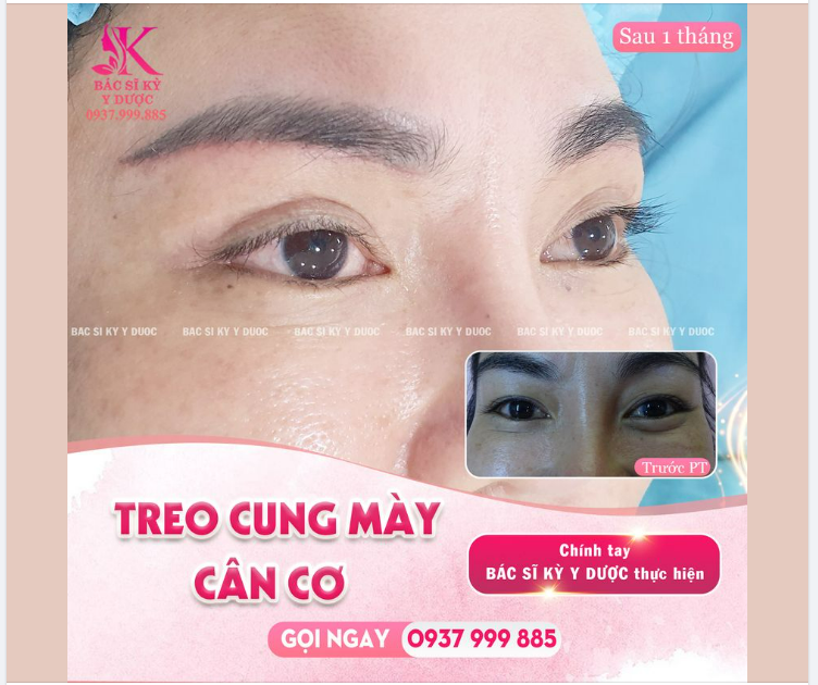 Khách hàng TREO CUNG MÀY 