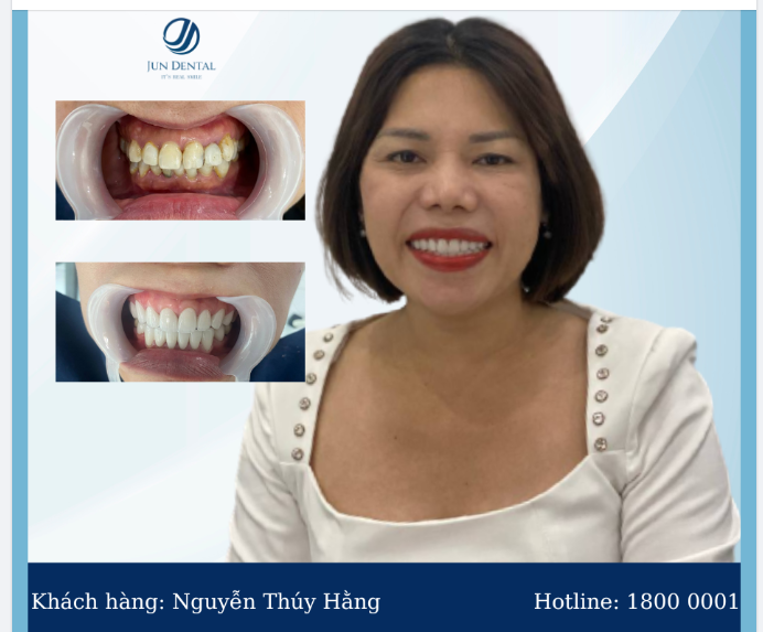 MẶC KỆ CÁI LẠNH CỦA MÙA ĐÔNG ĐỂ ĐỔI LẠI NỤ CƯỜI VÔ GIÁ