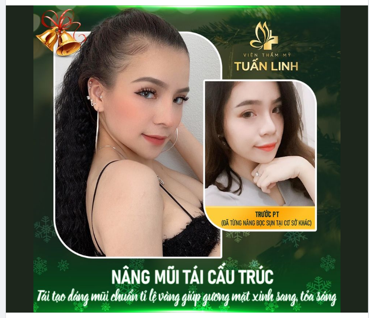 GẦN MỰC THÌ ĐEN, GẦN TUẤN LINH THÌ ĐẸP!!