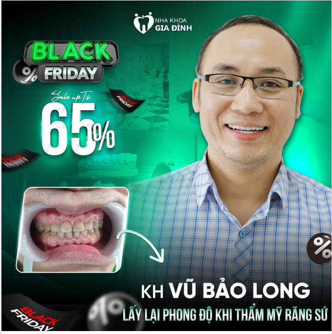 TẠI SAO BẠN VẪN ĐỂ HÀM RĂNG XỈN MÀU LÀM ẢNH HƯỞNG ĐẾN PHONG ĐỘ CỦA CHÍNH MÌNH?