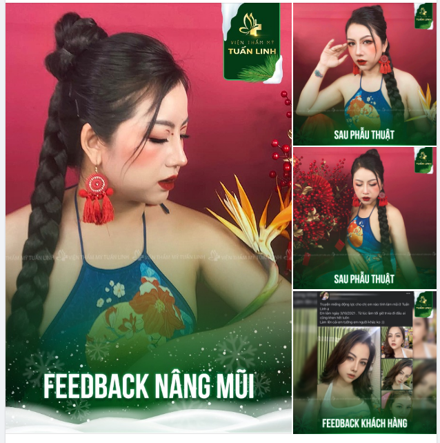 NÂNG MŨI CAO SANG - NĂM MỚI TỎA SÁNG!!!