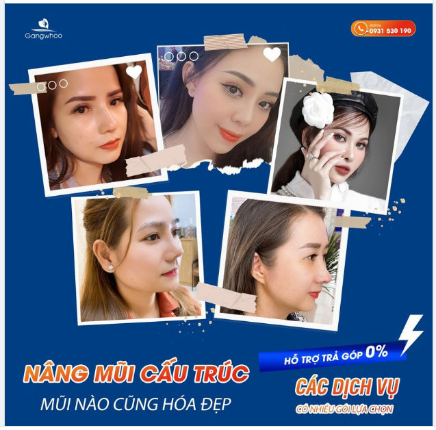 NÂNG MŨI CẤU TRÚC - MŨI NÀO CŨNG HÓA ĐẸP