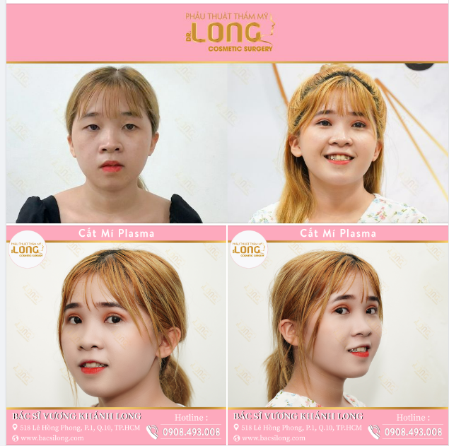 CẮT MÍ PHƯƠNG PHÁP LÀM ĐẸP ĐỐN HẠ TIM MỌI CÔ GÁI