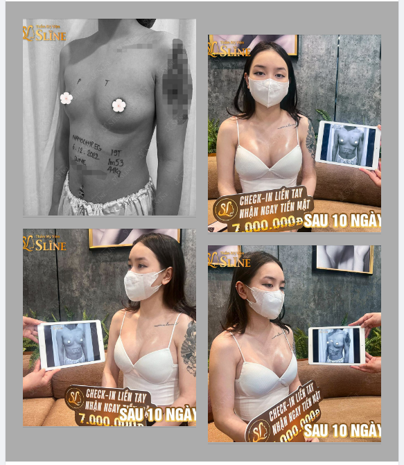 THẾ NÀO LÀ V1 VẠN NGƯỜI MÊ ?