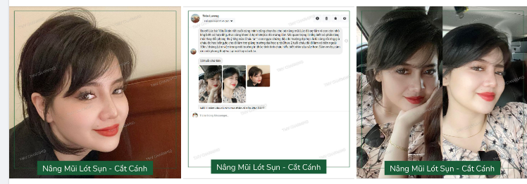 Đính chính là bác Khanh hổng có làm mũi phong thuỷ nha cả nhà ​​​​​​​ Bác Khanh chỉ làm mũi đẹp thôi