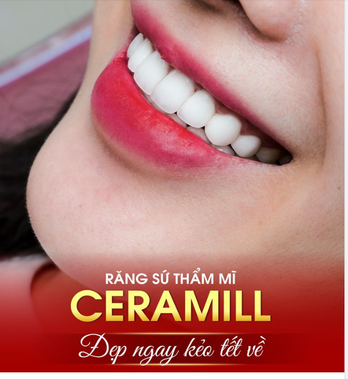Răng sứ Ceramill - Đỉnh cao trong thẩm mỹ răng sứ
