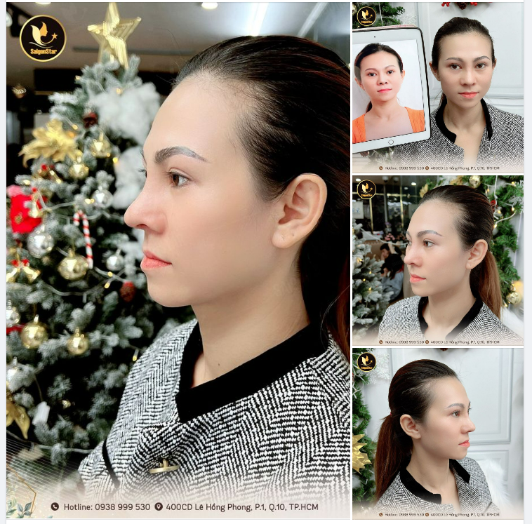 Giáng sinh cận kề - Đến Saigon Star nâng mũi nào các chị em!