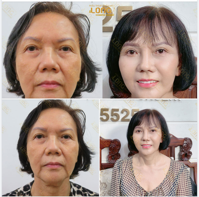 ​​​​​​​DA ĐẸP ĐÓN GIÁNG SINH RINH NGAY GIÁ ƯU ĐÃI