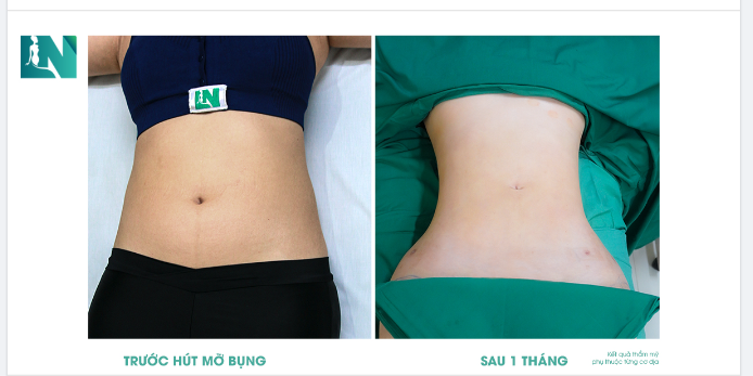 EO ĐẸP – TỰ TIN KHOE TRỌN DÁNG THON!