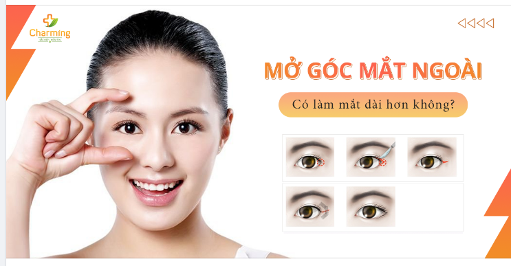 MỞ GÓC MẮT NGOÀI CÓ KHIẾN MẮT DÀI HƠN KHÔNG?