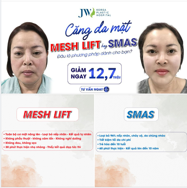 CĂNG DA MẶT MESH LIFT hay SMAS - Phương pháp nào dành cho bạn?
