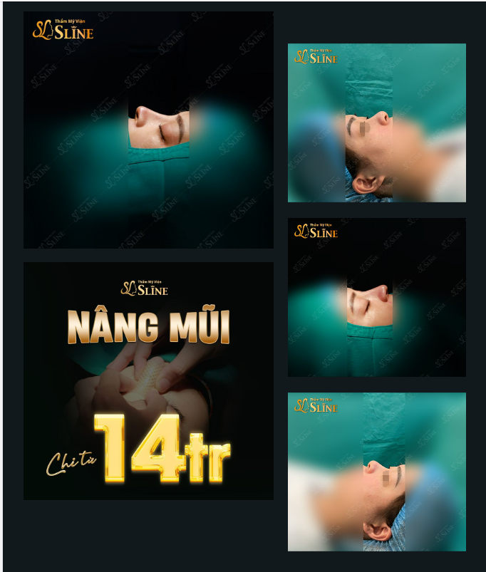 Có thể bạn chưa biết : “Mũi là bộ phận quyết định 70% nhan sắc của bạn.”