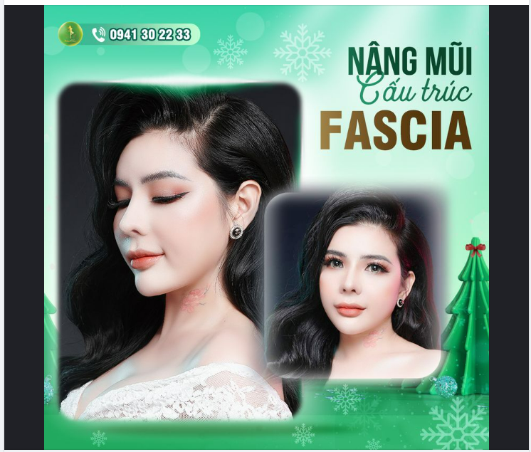 HOT GIRL TRANG DOLLY THAY ĐỔI THẾ NÀO SAU NÂNG MŨI TẠI SAIGON VENUS?