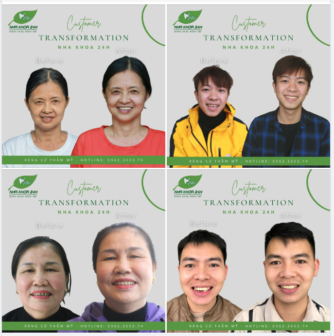 ĐẶT LỊCH LIỀN TAY - NHẬN NGAY ƯU ĐÃI 40% RĂNG SỨ THẨM MỸ - CHỈ TỪ 2,6TR/RĂNG