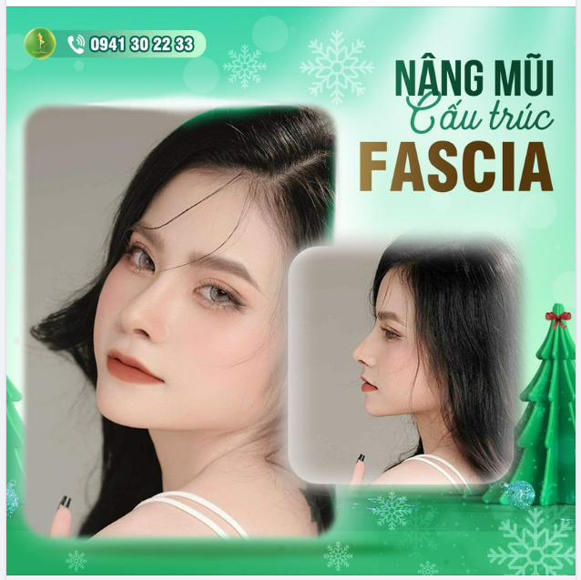 ƯU ĐÃI CỰC LỚN - THỜI ĐIỂM VÀNG NÂNG MŨI