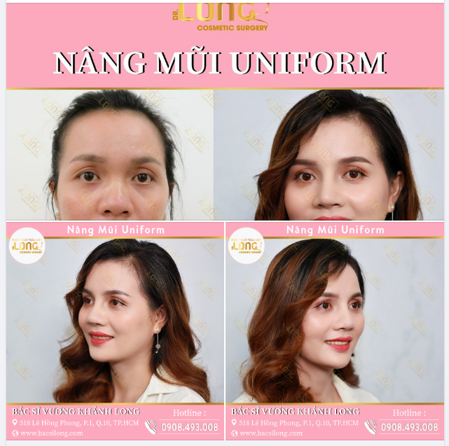 SALE ĐẮM SAY - ĐẸP NGẤT NGÂY MŨI ĐẸP VẠN ĐIỀU MAY KÉO ĐẾN