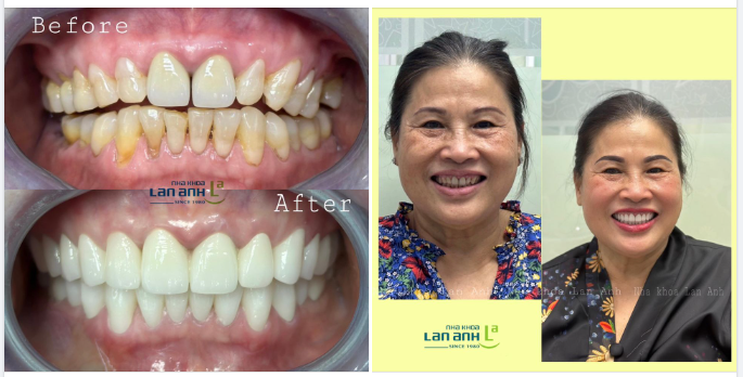Nụ cười không tốn kém, miễn phí hoàn toàn nhưng đem lại rất nhiều giá trị.