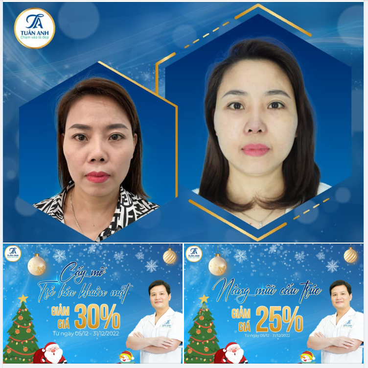 Combo thay đổi diện mạo đẹp ngay chỉ sau 2 tuần, không mất nhiều thời gian nghỉ dưỡng
