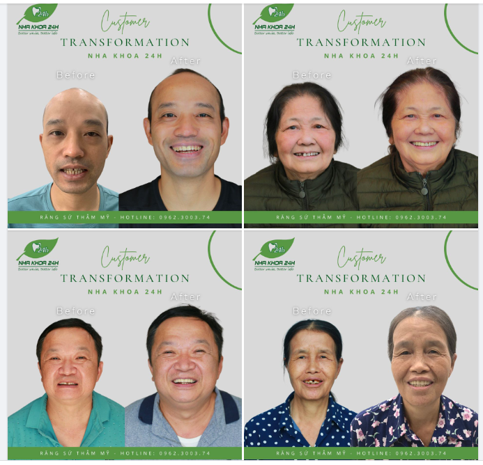 NHẬN NGAY ƯU ĐÃI 50% RĂNG SỨ THẨM MỸ - CHỈ TỪ 2,8TR/RĂNG