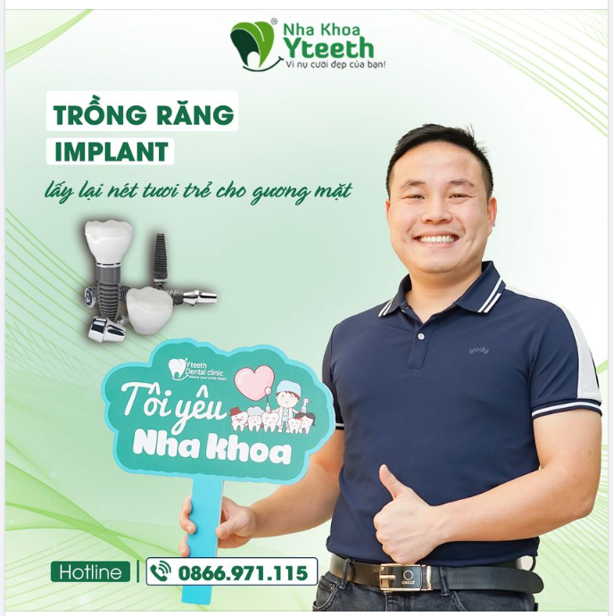 4 Ưu điểm vượt trội khi trồng răng implant mà cầu răng không có