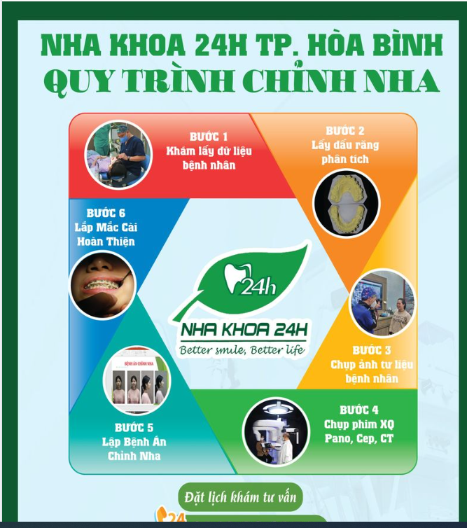 QUY TRÌNH CHỈNH NHA CHUYÊN NGHIỆP TẠI NHA KHOA 24H TP. HÒA BÌNH
