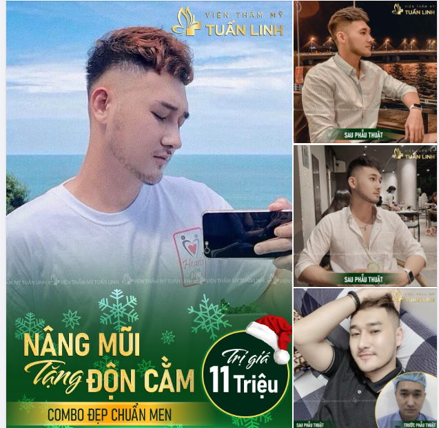 ĐỪNG QUÊN CHƯƠNG TRÌNH NÂNG MŨI TẬNG ĐỘN CẰM ĐANG DIỄN RA TUẤN LINH NHA!!