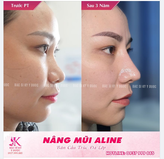 TÂN TRANG CHIẾC MŨI - RỘN RÀNG XUÂN SANG
