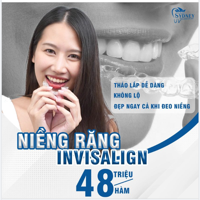 Invisalign – Niềng răng vô hình
