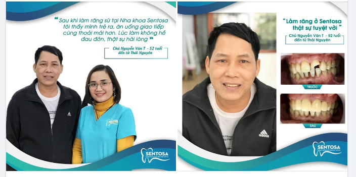 “LÀM RĂNG SỨ TẠI SENTOSA, TÔI THẤY MÌNH TRẺ RA, ĂN UỐNG GIAO TIẾP CUNG THOẢI MÁI HƠN. LÚC LÀM KHÔNG HỀ ĐAU ĐỚN, THOẢI MÁI, THỰC SỰ HÀI LÒNG”
