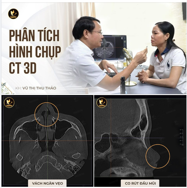 PHÂN TÍCH TÌNH TRẠNG CT 3D