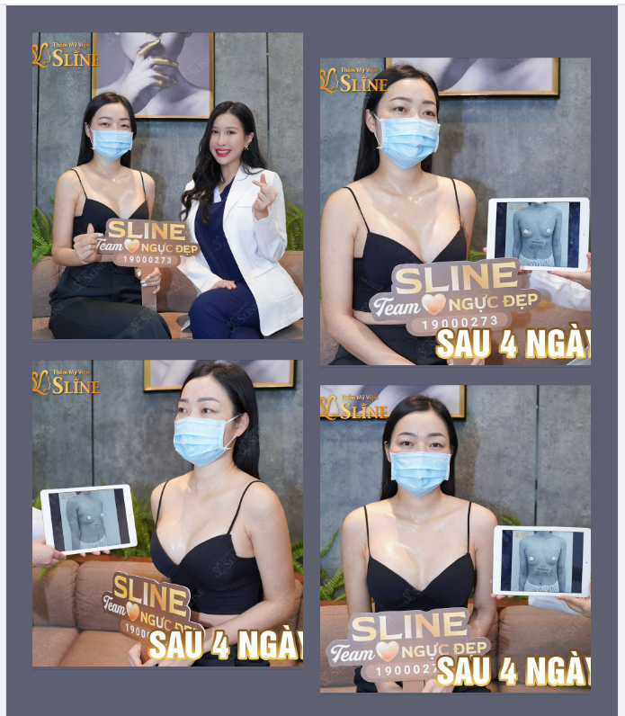 Đừng sợ đau mà chỉ nên sợ “ĐẸP QUÁ THÔI”!
