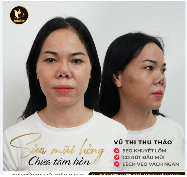 MAY MẮN LIỆU CÓ MỈM CƯỜI VỚI NGƯỜI MẸ ĐƠN THÂN?