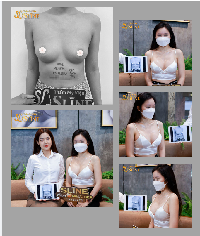 Ngực xinh cân mọi góc hình HÌNH ẢNH V1 SAU 12 NGÀY TUỔI VỚI DÒNG TÚI MENTOR
