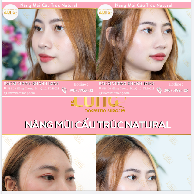 MŨI SIÊU XINH ĐÓN LỄ TẾT VUI LINH ĐÌNH