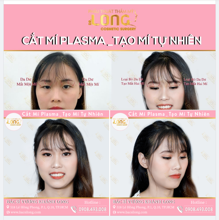 THÁNG 12 ƯU ĐÃI LÀM ĐẸP CÓ 1 KHÔNG 2
