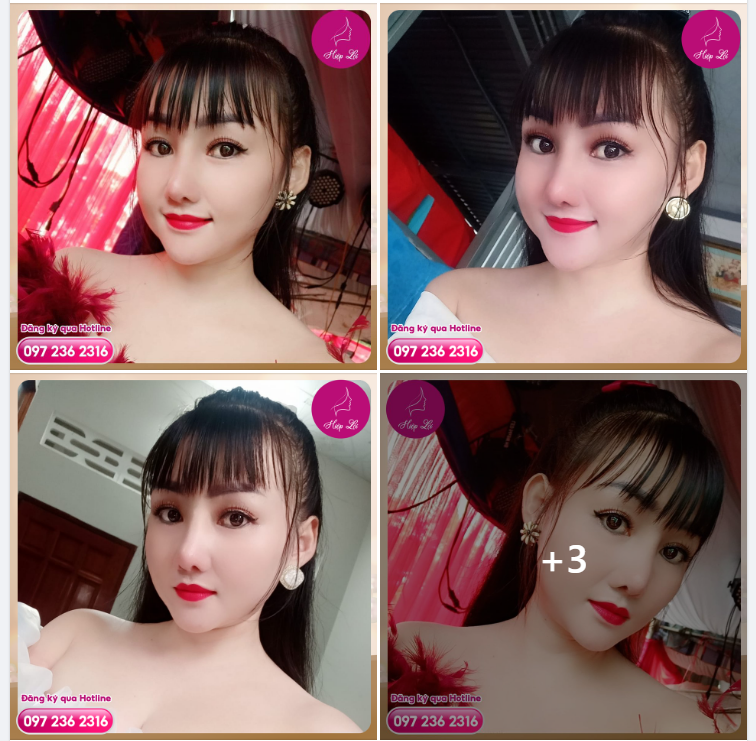 Feedback Combo Mũi - Cằm - Combo tự tin cân ngàn outfit của nàng khách xinh đẹp sau 1 tháng làm tại Hiệp Lợi!