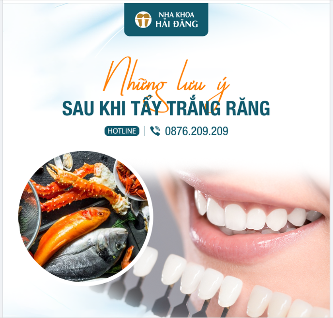 NHỮNG LƯU Ý SAU KHI TẨY TRẮNG RĂNG