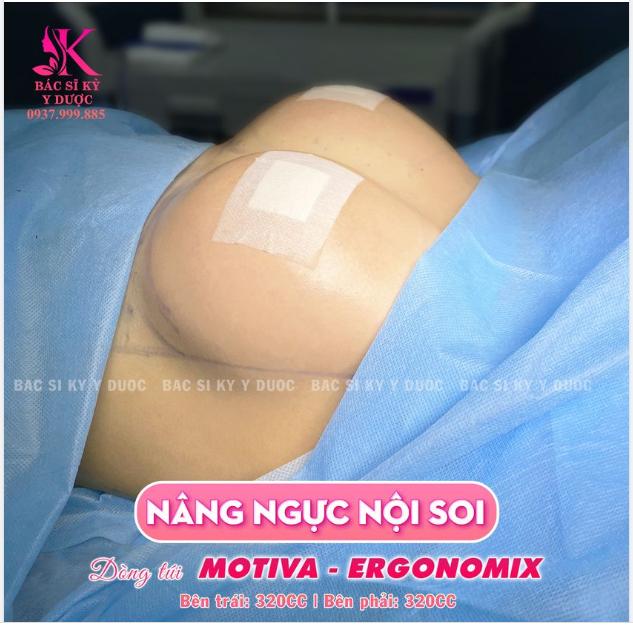 Thời điêmt này không đi làm đẹp thì đến khi nào