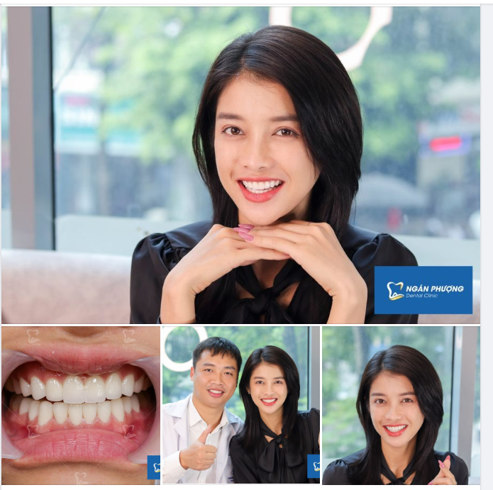 Tạm biệt hàm răng trắng sáng, diễn viên Mỹ Duyên