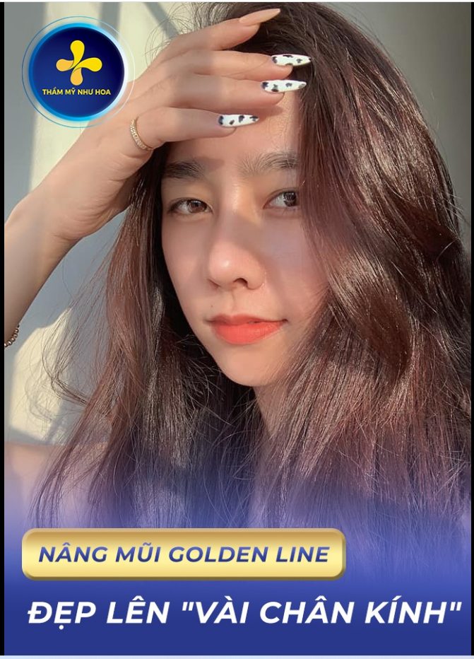 Khách hàng của TM Như Hoa đã đẹp lên "vài chân kính" chỉ bằng duy nhất 1 dịch vụ - NÂNG MŨI GOLDEN LINE