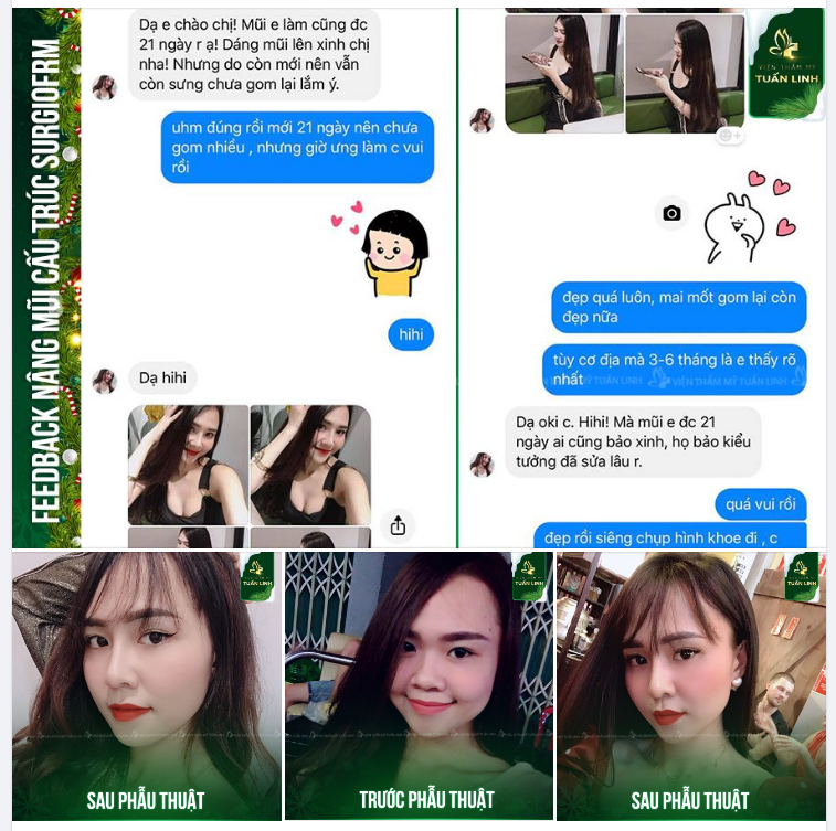''CHÂN ÁI '' KHI NÂNG MŨI TẠI TUẤN LINH