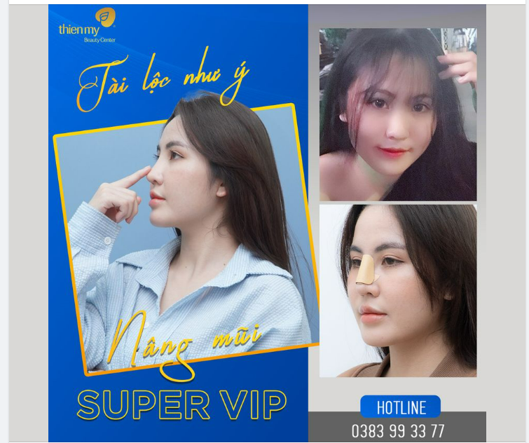 Tài lộc như ý với nâng mũi Super Vip