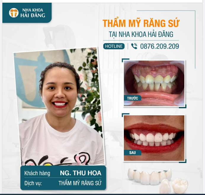 RĂNG XINH LUNG LINH - TỰ TIN GIAO TIẾP