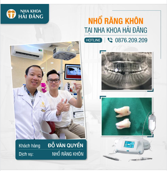 NHỔ RĂNG KHÔN: NHẸ NHÀNG, ÊM ÁI, KHÔNG ĐAU CHÚT NÀO!