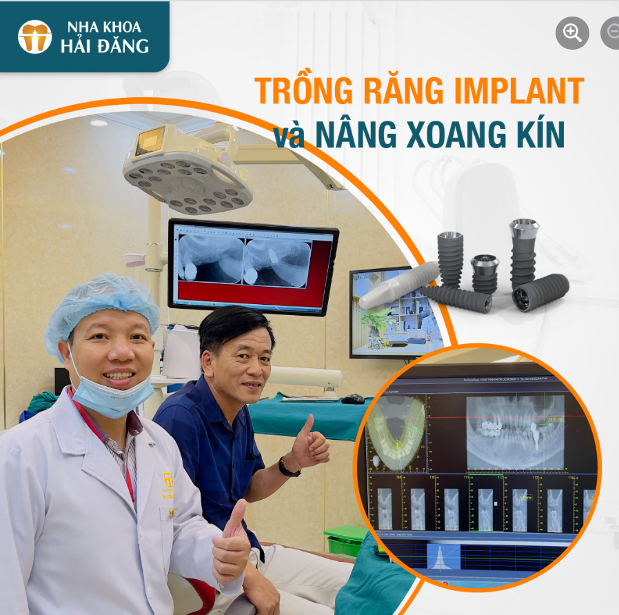 Trồng răng implant và nâng xoang kín